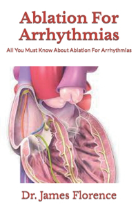 Ablation For Arrhythmias