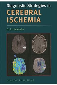 Cerebral Ischemia