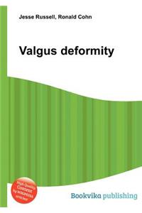 Valgus Deformity