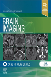 Brain Imaging Case Review