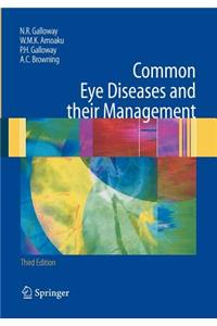 Common Eye Diseases and Their Management
