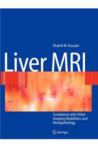 Liver MRI