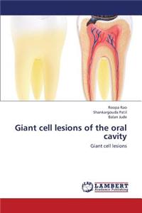 Giant Cell Lesions of the Oral Cavity