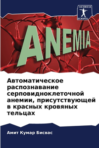 Автоматическое распознавание серповид&