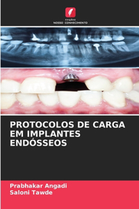 Protocolos de Carga Em Implantes Endósseos