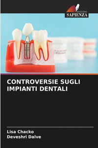 Controversie Sugli Impianti Dentali