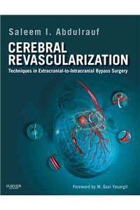 Cerebral Revascularization