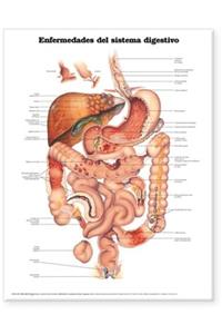 Diseases of the Digestive System Anatomical Chart in Spanish (Enfermedades del Sistema Digestivo)