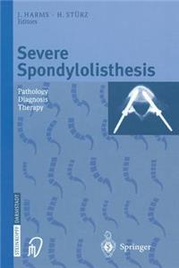 Severe Spondylolisthesis