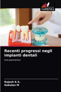 Recenti progressi negli impianti dentali