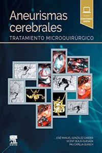 Aneurismas cerebrales: Tratamiento microquirurgico