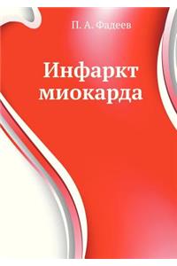 Инфаркт миокарда