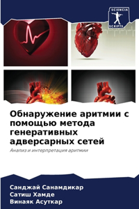 Обнаружение аритмии с помощью метода гене