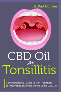 CBD Oil for Tonsillitis