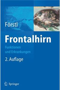 Frontalhirn