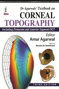 Dr Agarwalsâ€™ Textbook on Corneal Topography Including Pentacam and Anterior Segment OCT