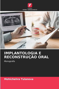 Implantologia E Reconstrução Oral