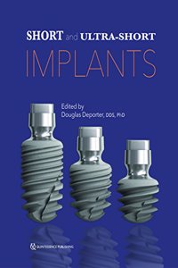 Short and Ultra-Short Implants Paperback â€“ 10 September 2018