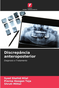 Discrepância anteroposterior