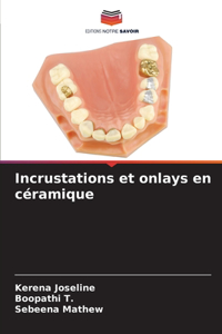 Incrustations et onlays en céramique