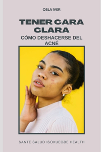 Tener Cara Clara; Cómo Deshacerse del Acné