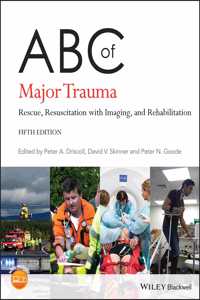 ABC of Major Trauma