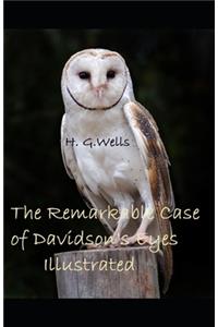 The Remarkable Case of Davidson's Eyes Illustrated