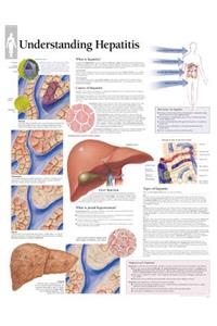 Understanding Hepatitis Laminated Poster