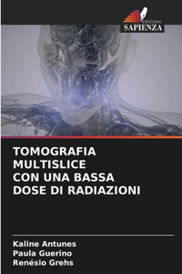 Tomografia Multislice Con Una Bassa Dose Di Radiazioni