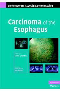 Carcinoma of the Esophagus