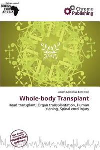 Whole-Body Transplant
