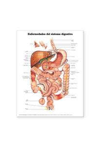 Diseases of the Digestive System Anatomical Chart in Spanish (Enfermedades del Sistema Digestivo)