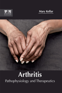 Arthritis: Pathophysiology and Therapeutics