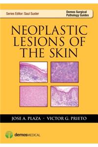 Neoplastic Lesions of the Skin