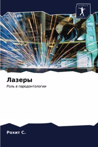 Лазеры
