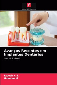 Avanços Recentes em Implantes Dentários