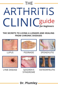 Arthritis Clinic Guide for Beginners