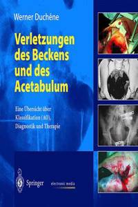 Verletzungen Des Beckens Und Des Acetabulum