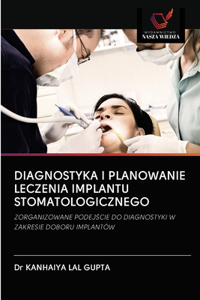Diagnostyka I Planowanie Leczenia Implantu Stomatologicznego