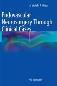 Endovascular Neurosurgery Through Clinical Cases