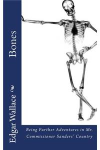 Bones
