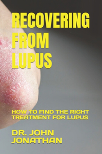 Recovering from Lupus