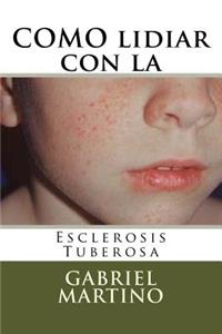 Como Lidiar Con La Esclerosis Tuberosa