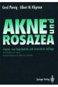 Akne
