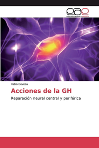 Acciones de la GH