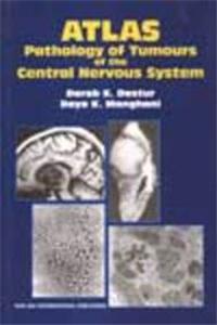 Atlas: Pathology Of Tumours Of The Central Nervous System