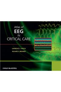 Atlas of EEG in Critical Care