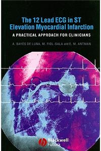 12-Lead ECG in ST Elevation Myocardial Infarction