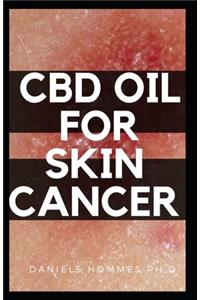 CBD Oil for Skin Cancer