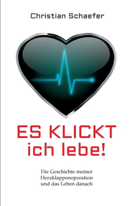 Es klickt, ich lebe!